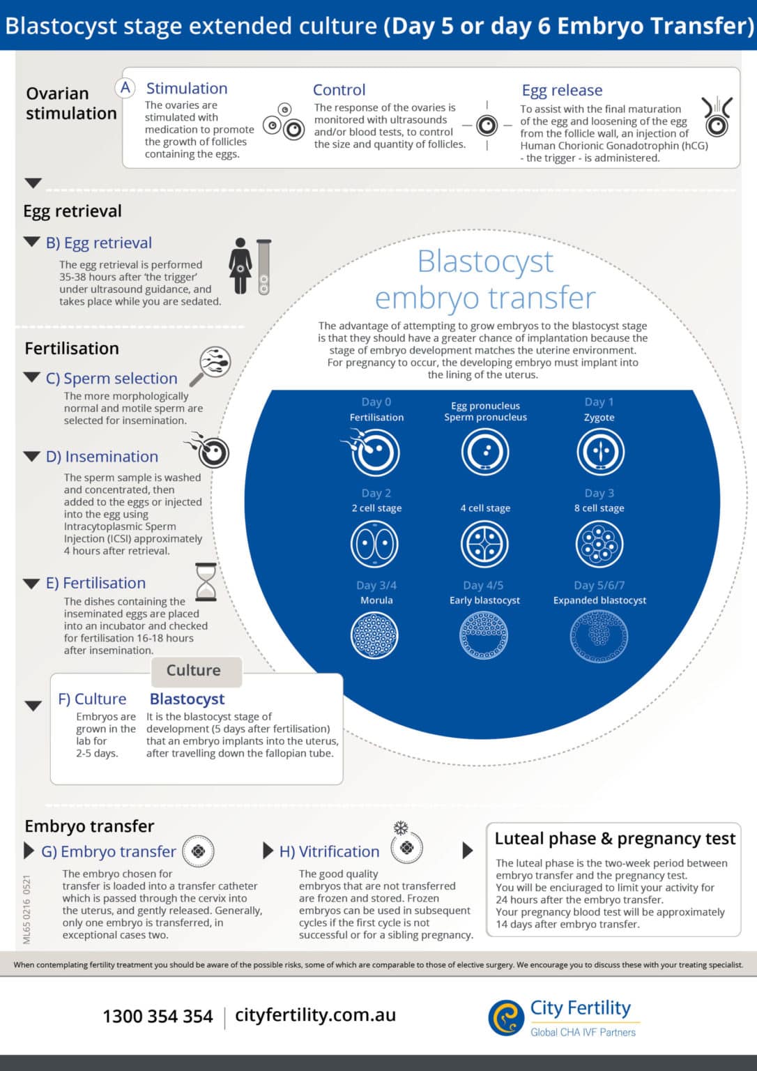 Blastocyst-stage extended culture infographic City Fertility