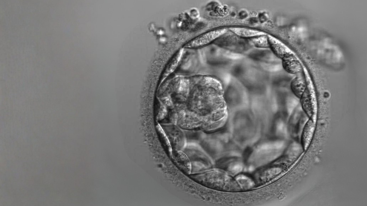 Embryo blastocyst